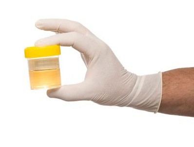 test urina za nechyporenko kako se okupiti