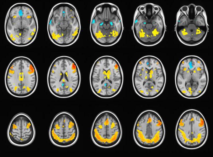 Dekodiranje MRI mozga